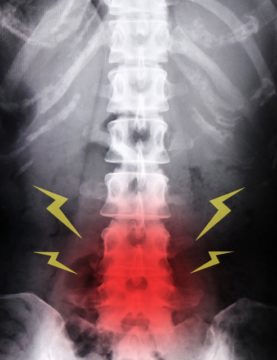 腰痛 | 港区赤坂の腰痛専門の整体-南青山整体院の画像
